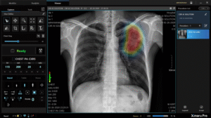 DETECTORI DIGITALI pentru UZ UMAN GENERAL